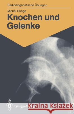 Knochen Und Gelenke: 170 Diagnostische Übungen Für Studenten Und Praktische Radiologen Bromhorst, Eleonore 9783540165439 Springer