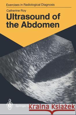 Ultrasound of the Abdomen: 114 Radiological Exercises for Students and Practitioners Roy, Catherine 9783540165460 Springer