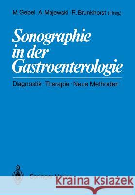 Sonographie in Der Gastroenterologie: Diagnostik -- Therapie -- Neue Methoden Gebel, Michael 9783540166207 Springer