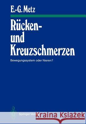 Rücken- Und Kreuzschmerzen: Bewegungssystem Oder Nieren? Metz, Erhard-Günter 9783540166269 Springer