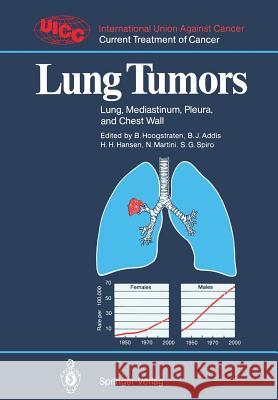 Lung Tumors: Lung, Mediastinum, Pleura, and Chest Wall Hoogstraten, Barth 9783540169208