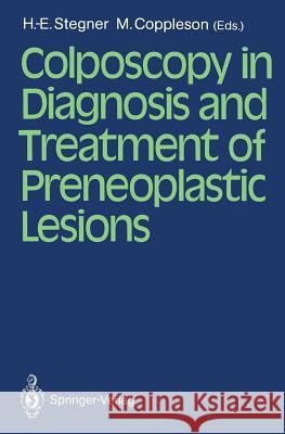 Colposcopy in Diagnosis and Treatment of Preneoplastic Lesions Hans-E Stegner Malcolm Coppleson 9783540179474 Springer