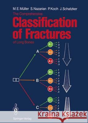 The Comprehensive Classification of Fractures of Long Bones M. E. Muller Maurice E. Muller Serge Nazarian 9783540181651