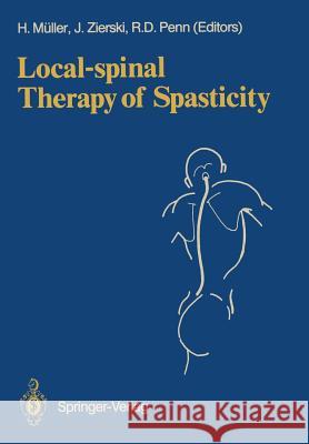 Local-Spinal Therapy of Spasticity Müller, Hermann 9783540182955 Springer
