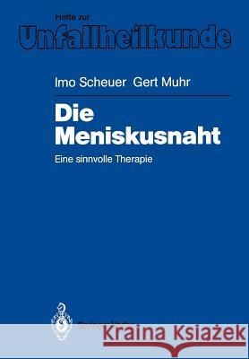 Die Meniskusnaht: Eine Sinnvolle Therapie Scheuer, Imo 9783540189572 Springer