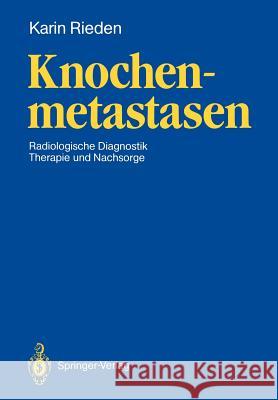 Knochenmetastasen: Radiologische Diagnostik, Therapie Und Nachsorge Rieden, Karin 9783540190622 Springer
