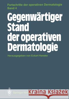 Gegenwärtiger Stand der operativen Dermatologie Eckart Haneke 9783540193210