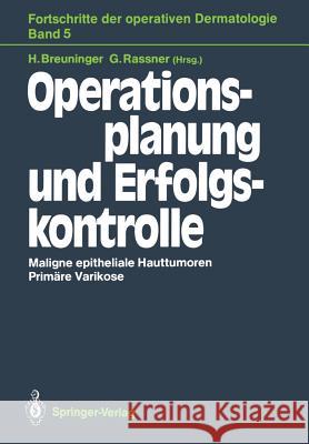 Operationsplanung und Erfolgskontrolle Helmut Breuninger, Gernot Rassner 9783540193227 Springer-Verlag Berlin and Heidelberg GmbH & 