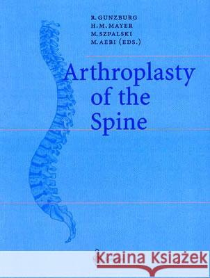 Arthroplasty of the Spine R. Gunzburg H. M. Mayer M. Szpalski 9783540202950 Springer