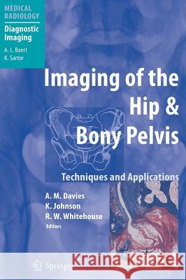 Imaging of the Hip & Bony Pelvis: Techniques and Applications Davies, A. Mark 9783540206408