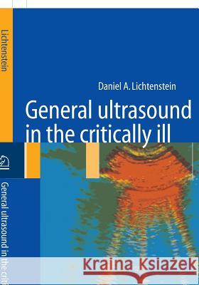 General Ultrasound in the Critically Ill Lichtenstein, Daniel A. 9783540208228 Springer