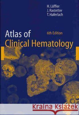 Atlas of Clinical Hematology Helmut Loffler H. Loeffler Helmut Lvffler 9783540210139 Springer
