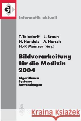 Bildverarbeitung Für Die Medizin 2004: Algorithmen - Systeme - Anwendungen Tolxdorff, Thomas 9783540210597 Springer