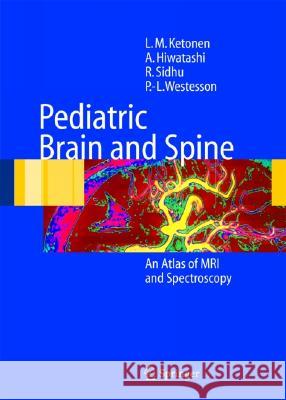 Pediatric Brain and Spine: An Atlas of MRI and Spectroscopy Ketonen, L. M. 9783540213406 Springer