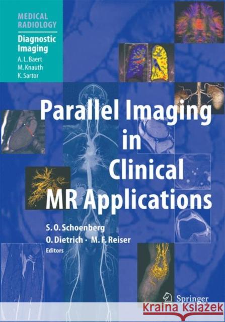 Parallel Imaging in Clinical MR Applications Stefan O. Schoenberg A. L. Baert 9783540231028 Springer