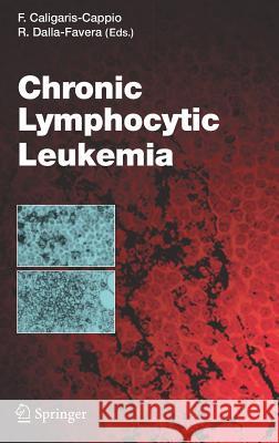 Chronic Lymphocytic Leukemia Caligaris-Cappio                         Federico Caligaris-Cappio 9783540252795 Springer