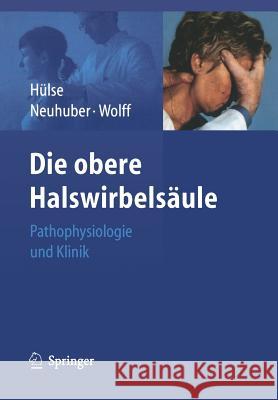Die Obere Halswirbelsäule: Pathophysiologie Und Klinik Hülse, Manfred 9783540256052 Springer