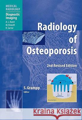 Radiology of Osteoporosis A.L. Baert, Stephan Grampp 9783540258889 Springer-Verlag Berlin and Heidelberg GmbH & 
