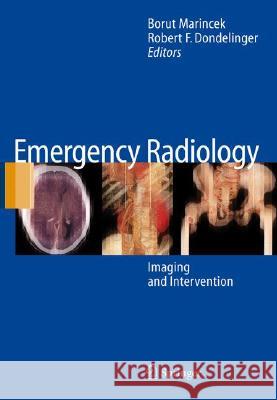 Emergency Radiology: Imaging and Intervention Marincek, Borut 9783540262275 Springer