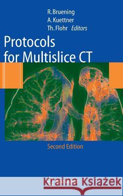 Protocols for Multislice CT  Brning 9783540272717 0