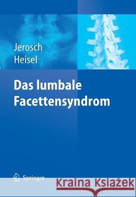 Das Lumbale Facettensyndrom Jerosch, Jörg 9783540277095