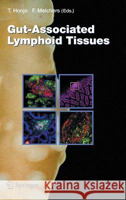 Gut-Associated Lymphoid Tissues Tasuku Honjo, Fritz Melchers 9783540306566