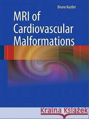 MRI of Cardiovascular Malformations Bruno Kastler 9783540307013 Springer