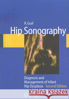 Hip Sonography : Diagnosis and Management of Infant Hip Dysplasia R. Graf S. Scott K. Lercher 9783540309574 