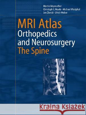 MRI Atlas: Orthopedics and Neurosurgery, the Spine Herwig, B. 9783540335337 Springer
