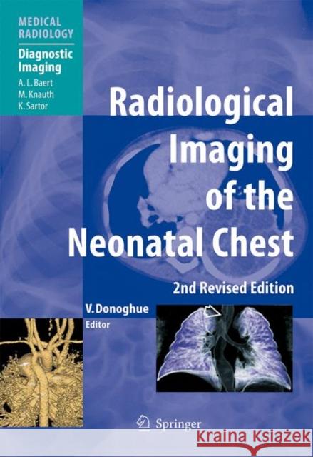 Radiological Imaging of the Neonatal Chest Veronica B. Donoghue A. L. Baert 9783540337485 Not Avail