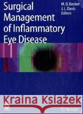 Surgical Management of Inflammatory Eye Disease Matthias Becker Janet Davis 9783540338611 Not Avail