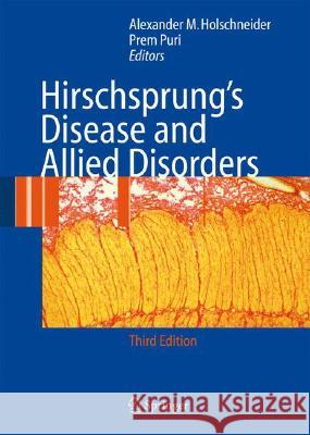 Hirschsprung's Disease and Allied Disorders Holschneider                             Alexander Matthias Holschneider Prem Puri 9783540339342 Springer