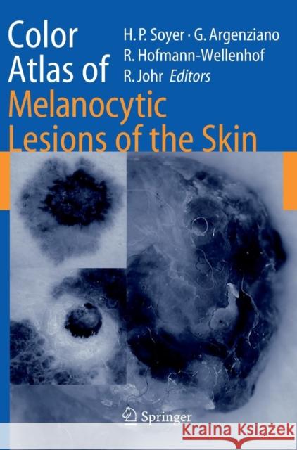 Color Atlas of Melanocytic Lesions of the Skin Giuseppe Argenziano Hans Peter Soyer Rainer Hofmann-Wellenhof 9783540351054