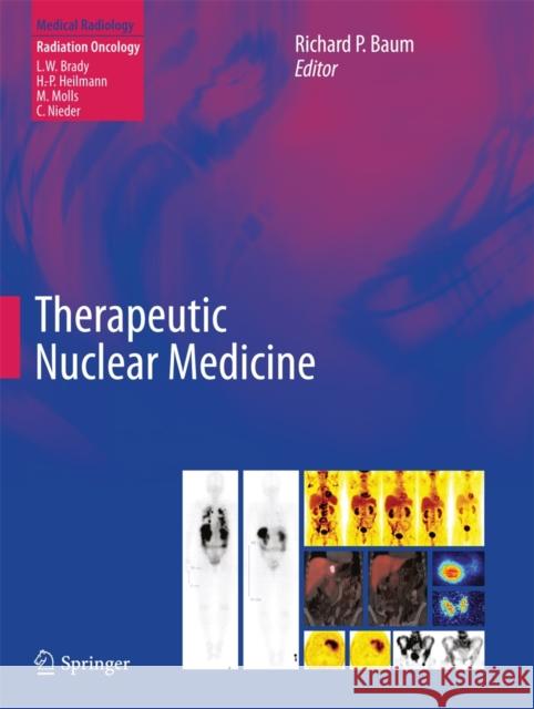 Therapeutic Nuclear Medicine Richard P. Baum 9783540367185 Not Avail