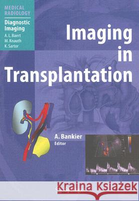 Imaging in Transplantation Alexander A. Bankier 9783540402299 Springer