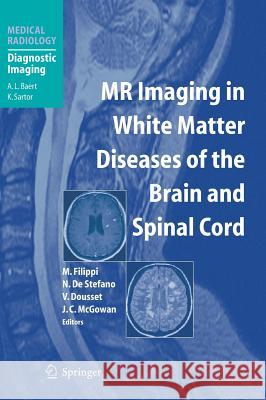 MR Imaging in White Matter Diseases of the Brain and Spinal Cord M. Filippi K. Sartor Massimo Filippi 9783540402305