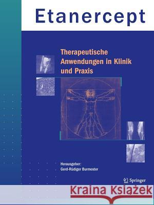 Etanercept - Therapeutische Anwendungen in Klinik Und Praxis Burmester, Gerd-Rüdiger 9783540404408 Springer