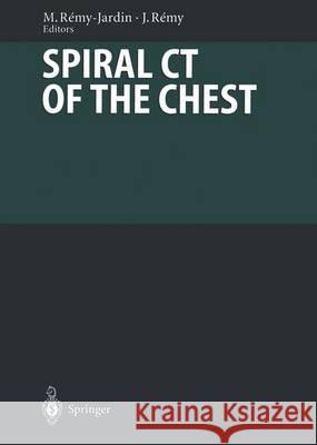 Spiral CT of the Chest Baert, A. L. 9783540411765