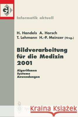 Bildverarbeitung Für Die Medizin 2001: Algorithmen -- Systeme -- Anwendungen Handels, Heinz 9783540416906 Springer