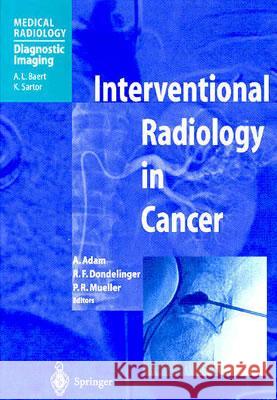 Interventional Radiology in Cancer Adams                                    A. Adams Dondelinger R F 9783540418733 Springer