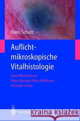 Auflichtmikroskopische Vitalhistologie: Dermatologischer Leitfaden Hans Schulz International Association of Geodesy 9783540422112 Springer