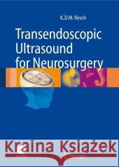 Transendoscopic Ultrasound for Neurosurgery Klaus-Dieter Maria Resch K. M. Resch 9783540425052 Springer