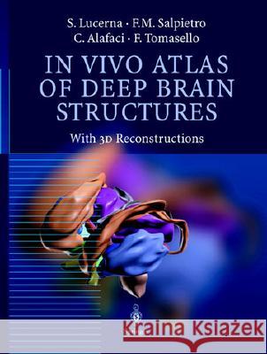 In Vivo Atlas of Deep Brain Structures: With 3D Reconstructions Lucerna, S. 9783540425618 Springer