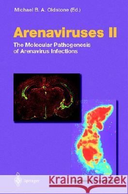 Arenaviruses II: The Molecular Pathogenesis of Arenavirus Infections M. B. a. Oldstone M. B. a. Olstone M. B. a. Oldstone 9783540427056 Springer