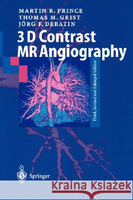 3D Contrast MR Angiography Martin R. Prince, Thomas M. Grist, Jörg F. Debatin 9783540428749 Springer-Verlag Berlin and Heidelberg GmbH & 