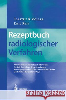 Rezeptbuch Radiologischer Verfahren Möller, Torsten B. 9783540429937