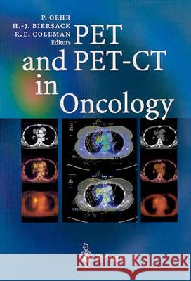 Pet and Pet-CT in Oncology Oehr, Peter 9783540431251 Springer