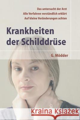 Krankheiten Der Schilddrüse Schützler, W. 9783540434238