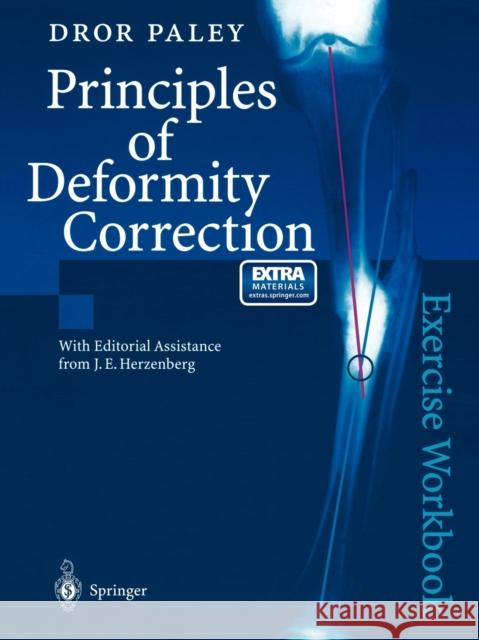 Principles of Deformity Correction: Exercise Workbook Herzenberg, J. E. 9783540441618 Springer