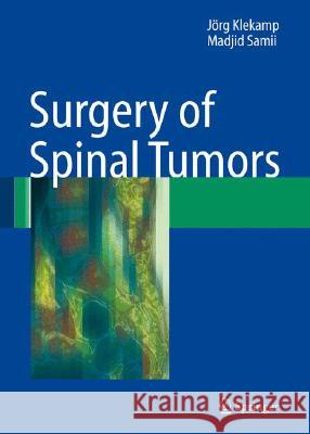 Surgery of Spinal Tumors Jc6rg Klekamp Madjid Samii Jvrg Klekamp 9783540447146 Springer